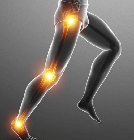 Lower Limbs Pain